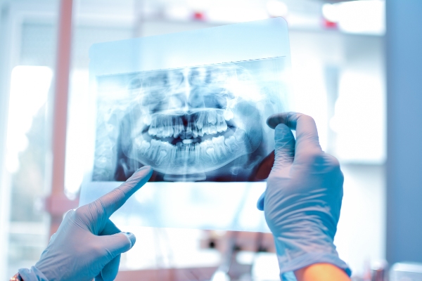 Are Dental X Rays Used In General Dentistry?