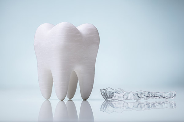 FAQs About Clear Aligners Answered