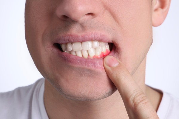 How A Family Dentist Provides Gum Disease Treatment