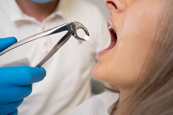 The Process Of Getting A Tooth Extraction